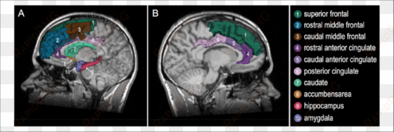 3-d model of the human brain superimposed on the mri - human brain