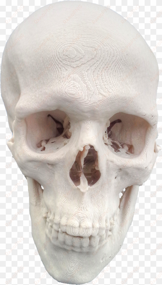 3dprinted skull 20151124090811 - creative commons