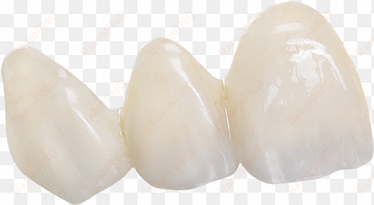 bruxzir anterior teeth - brassiere