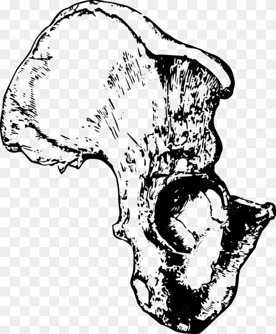 clip free download hemi pelvis hip big image png - pelvic bone png