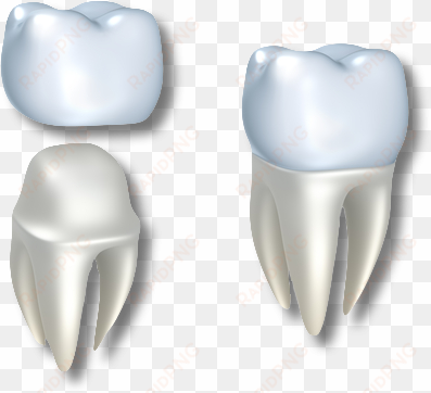 Dental Crown Transparent transparent png image