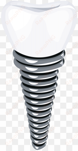 dental implant png clip art - implant png