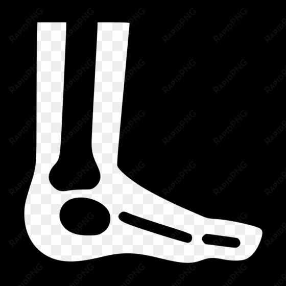 foot x ray comments - foot