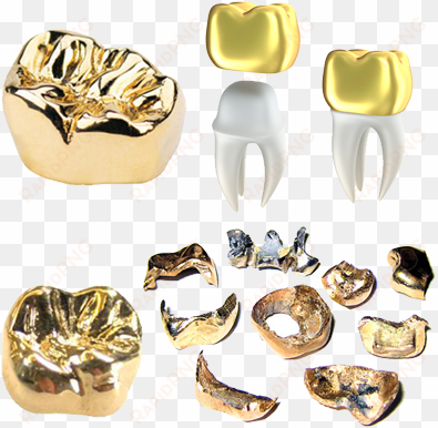 gold teeth caps we buy gold salem - gold crown tooth