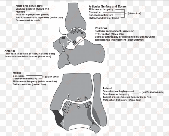 graphic library stock arrows drawing bone - posterior talofibular ligament