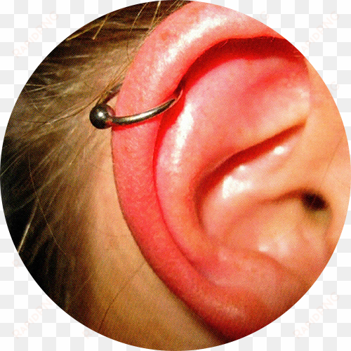 helix piercing - my cartilage piercing infected