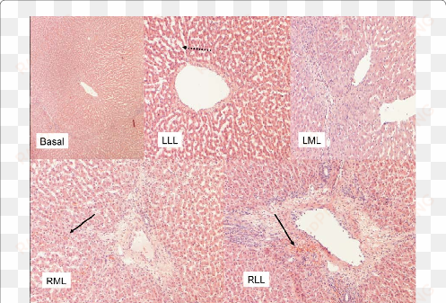 histological damage in biopsy specimens taken after - circle