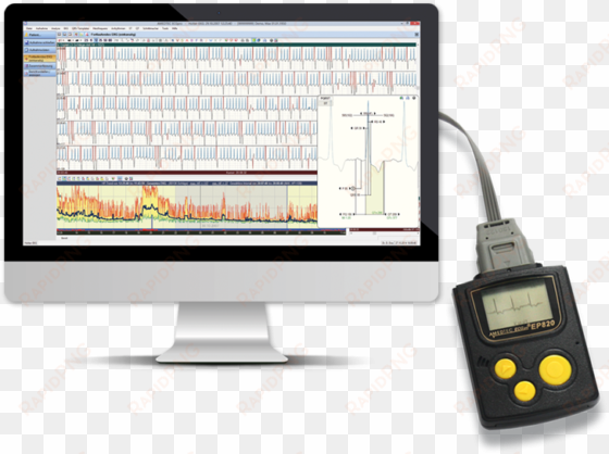 holter ecg - computer monitor