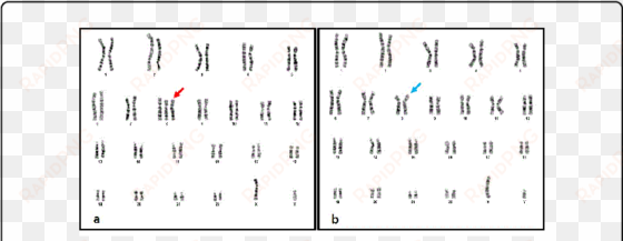 karyotype 47,xy, 8 , b - karyotype