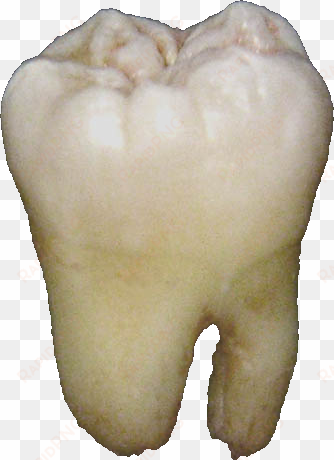 lower wisdom tooth - tooth png