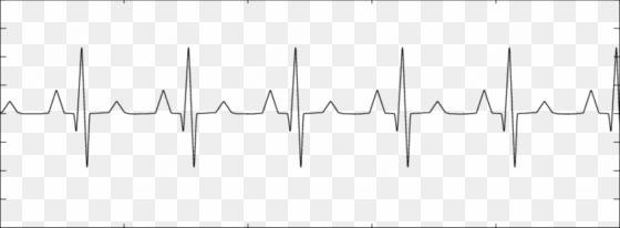 maternal heartbeat signal - plot
