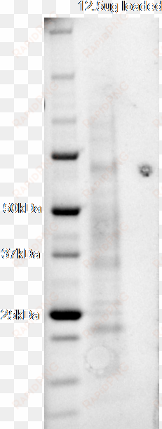 sds page of purified protein - user guide