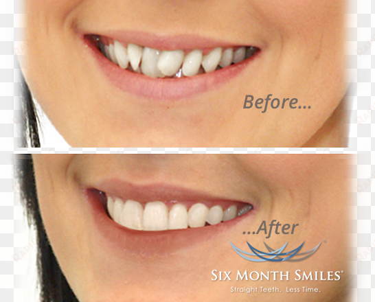slide-six month smile - lip gloss
