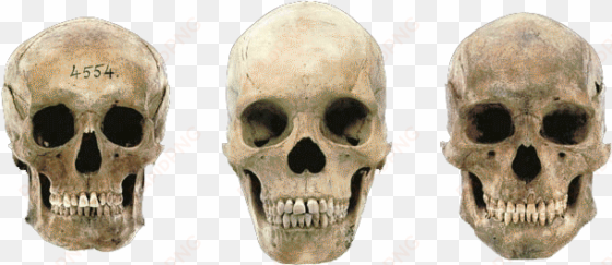 variations in modern human skulls - german male skull