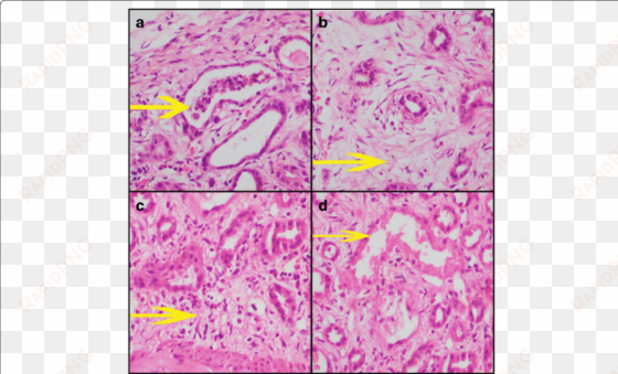 yellow arrow depicts as follows - tubule